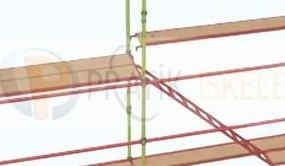 Cup lock scaffolding kurulum